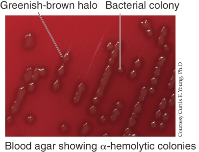An example of a bacterial species that shows the growth pattern seen below is ________.   A)  Streptococcus pyogenes B)  Streptococcus pneumoniae C)  E. coli D)  Salmonella