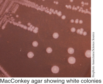 An example of a bacterial species that shows the growth pattern seen below is ________.   A)  Streptococcus pyogenes B)  Streptococcus pneumoniae C)  E. coli D)  Salmonella