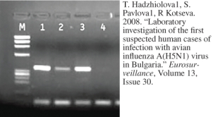 The procedure illustrated below is ________.   A)  an ELISA test B)  a PCR test C)  an antibody agglutination assay D)  gel electrophoresis