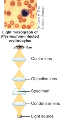 The image below represents a(n) : ________.   A)  Dark field microscope B)  Bright field microscope C)  Fluorescence microscope D)  Phase contrast microscope