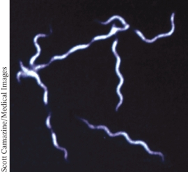 What type of microscope was used to produce the image below?   A)  Dark field microscope B)  Bright field microscope C)  Fluorescence microscope D)  Phase contrast microscope