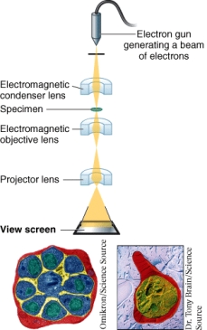 What type of microscope is shown below?   A)  Bright field microscope B)  Transmission electron microscope C)  Fluorescence microscope D)  Dark field microscope