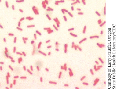 The bright field light micrograph below is an image of: ________.   A)  gram positive bacterial cells B)  gram negative bacterial cells C)  acid fast bacterial cells D)  bacterial cells with endospores