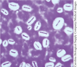 The light micrograph below is an example of: ________.   A)  A capsule stain B)  An acid fast stain C)  An endospore stain D)  Dark field microscopy