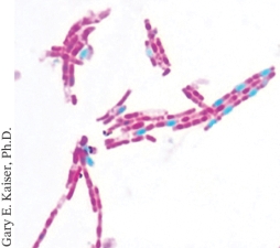 The light micrograph below is an example of: ________.   A)  A capsule stain B)  An acid fast stain C)  An endospore stain D)  A Gram stain