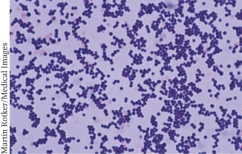 Examine the micrograph and determine what features can be used to identify this potential pathogen. (Select all that apply)    A)  Color B)  Shape C)  Number D)  Arrangement