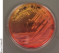 Culture media, such as the example shown below, help identify microbial specimens in the laboratory because they contain ________.   A)  additional protein B)  a buffer to maintain the pH C)  indicator dyes D)  reduced salts to adjust the osmotic environment