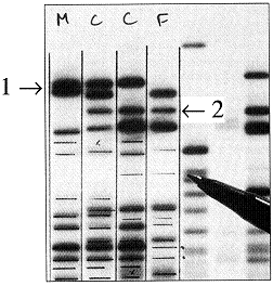 Figure 15-3   The columns in the accompanying figure represent F (for female) , C (for children) , and M (for male) . The presence of the band marked with arrow #2, shows that: A)  this DNA sequence in the children is a mutation. B)  this DNA sequence in the children is inherited from their mother. C)  this DNA sequence in the children is inherited from their father. D)  this sequence in the children is inherited from both their mother and father. E)  individual F is not the mother of these children.