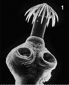 Figure 31-3   The structure shown in the accompanying figure is from an animal in phylum: A)  Cestoda. B)  Turbellaria. C)  Trematoda. D)  Monogenea. E)  Platyhelminthes.