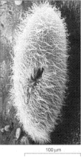 The accompanying image is the product which type of microscope?   A)  phase-contrast light microscope B)  Nomarski differential interference microscope C)  transmission electron microscope D)  scanning electron microscope E)  confocal fluorescence microscope