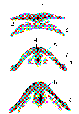 Figure 51-4 .   Refer to the accompanying figure. The structure labeled as 2 is the: A)  neural plate B)  neural fold C)  notochord D)  somite E)  neural crest