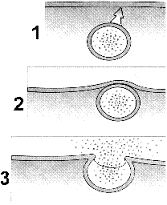 Figure 5-2     What cellular process is represented in the accompanying figure? A)  Lysis B)  Exocytosis C)  Cotransport D)  Pinocytosis E)  Facilitated diffusion