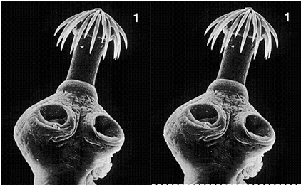 Figure 31-3 ​   Which of the following is characteristic of nemerteans? A)  Most burrow in dry soil. B)  They have wide bodies. C)  They have no proboscis. D)  They are all less than 1 cm in length. E)  They have no heart.