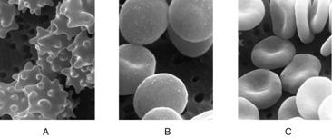 Labeling  These micrographs show the effects of various aqueous environments on red blood cells. Identify the correct environment depicted in each panel.  