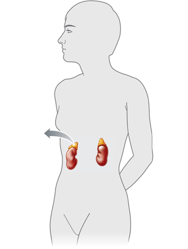       Figure 42.4 Answer the question using the accompanying figure. The ____ glands are shown in this figure. ​ A) thyroid B) pituitary C) adrenal D) pancreatic E) pineal