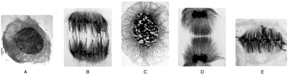   Figure 10.1 -Answer the following questions using the accompanying figure.  Identify the stage of mitosis shown in panel C. A)  interphase B)  prophase C)  metaphase D)  anaphase E)  telophase