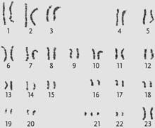 <strong>  Figure 13.5a Which genetic condition is revealed in the karyotype display shown in the accompanying figure?</strong> A) Turner syndrome B) Down syndrome C) cri-du-chat D) Triple-X syndrome E) Klinefelter syndrome <div style=padding-top: 35px> 