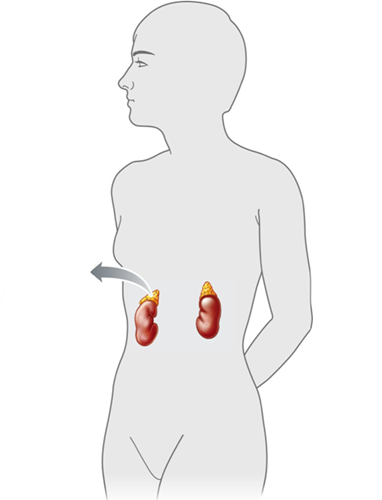    -Answer the question using the accompanying figure. The ____ glands are shown in this figure. A)  thyroid B)  pituitary C)  adrenal D)  pancreatic E)  pineal
