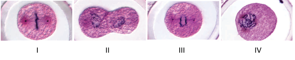 Examine the micrographs below to answer the following question.     The cell in micrograph  I  is at which stage of the cell cycle? A) prophase B) telophase C) interphase D) anaphase E) metaphase