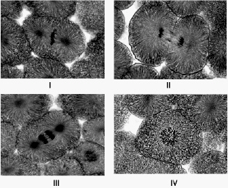   Examine the micrographs above and answer the following question(s) . The cell in micrograph  II  is at which stage of the cell cycle? A)  prophase B)  telophase C)  interphase D)  anaphase E)  metaphase