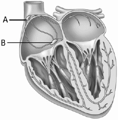 In this diagram of the heart, which of the following choices correctly identifies A and B?   A)  A is the AV node; B is the cardiac pacemaker. B)  A is the SA node; B is the septum. C)  A is the AV node; B is the SA node. D)  A is the SA node; B is the AV node. E)  A is the septum; B is the cardiac pacemaker.