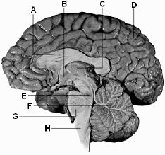   Use the above figure to answer the following question(s) . Referring to the above diagram of the brain, H identifies which region? A)  corpus callosum B)  hypothalamus C)  cerebrum D)  midbrain E)  medulla oblongata
