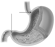 The arrows in the given diagram are pointing to the ____.   A)  esophagus and small intestine B)  trachea and large intestine C)  sphincters at the top and bottom of the stomach D)  esophagus and pancreas E)  stomach