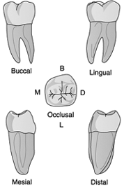 Identify the tooth in the illustration above. A) Maxillary first molar ...