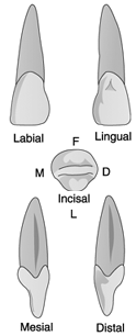   Identify the tooth in the illustration above. A)  Maxillary central B)  Maxillary lateral C)  Mandibular central D)  None of the above