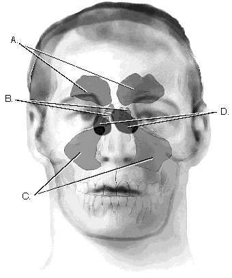 Complete the following questions by identifying the labeled structure related to the sinuses.     The structures labeled B are the ______________________________.