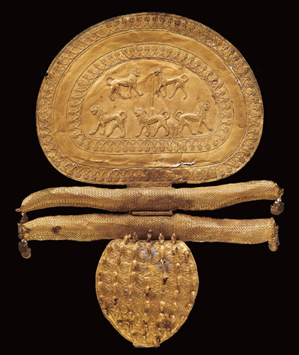 ​   What is the name of this object? A)  Pectoral B)  Hat pin C)  Earring D)  Fibula