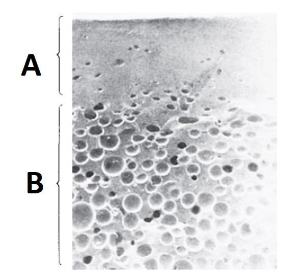 In molding, which part is represented by  A ?    A)  cellular core B)  expanded phase C)  solid skin D)  collapsing bubbles