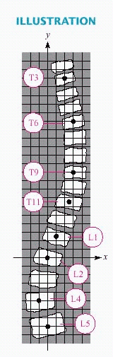  Scoliosis is a lateral curvature of the spine that can be more easily detected when a grid is superimposed over an X ray. Select the ordered pair that is not one of the  center points  of the labeled vertebrae. Note that T3 means the third thoracic vertebra, L4 means the fourth lumbar vertebra, and so on.   A)   ( - 1 , - 5 )   B)   ( - 2,3 )   C) (3,10)  D) (3,16)  E) (0,0)  